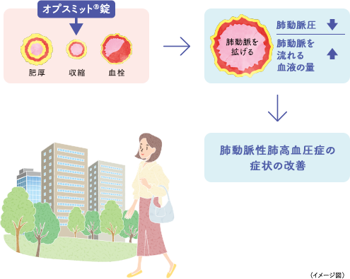 オプスミット<sup>®</sup>錠の効果